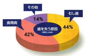 むし歯予防